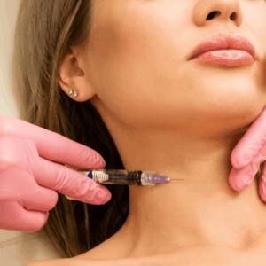 HyperDiluted Neck Filler | Radiesse